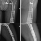 Ortopedyczna terapia bezoperacyjna